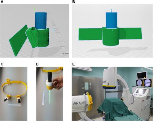 Figure 1 Three-dimensional model drawings of laser pointer and pedestal (A and B) and the physical photos of the novel device (C and D). The blue object represents the laser pointer and the green object represents the corresponding pedestal. The yellow round strap is used to attach to the G-arm’s image intensifier (E).
