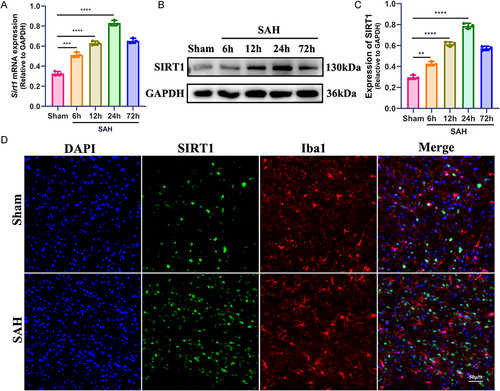 Figure 1 Temporal expression of SIRT1 in the cortex after SAH. (A–C), q-PCR and Western blot showed SIRT1 expression in sham at 6h, 12h, 24h, and 72h after SAH. (D), Co-staining of SIRT1 (green) and Iba1 (red) demonstrated that SIRT1 was upregulated in microglia 24 h after SAH. **P < 0.01, ***P < 0.001, ****P < 0.0001. Scale bar: 50 μm.