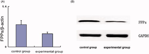 Figure 6. (A) Electrophoretic results of the two groups and (B) intracellular expression of FPPS in two groups.