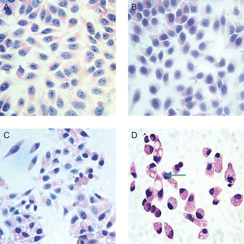 Figure 1.  Matrine changed the morphology of HepG2 and induced part cells to death. HepG2 cell incubated with different concentration of matrine for 4 days were harvested for H&E staining (×400magnification) to view cell morphology under multifunctional microscope. Untreated cells served as control (A), and treated cells were shown in 0.2 mg/mL (B); 1.5 mg/mL (C); 3.0 mg/mL (D) and the green arrow indicated the plasmatorrhexis.