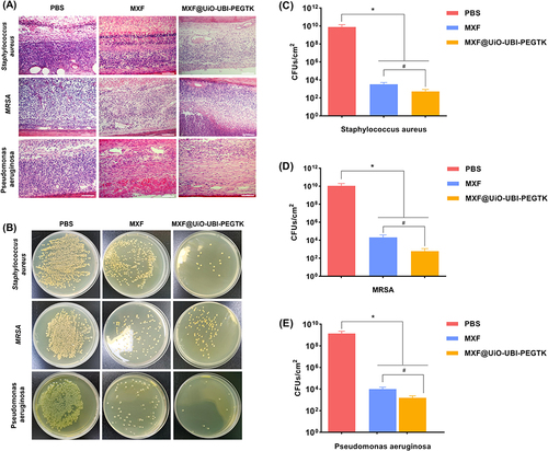 Figure 8 Histopathological evaluation of the antibacterial effects on endophthalmitis. (A) HE-staining photographs of the retinal tissues in endophthalmitis induced by S. aureus, MRSA, and P. aeruginosa treated with PBS, MXF, or MXF@UiO-UBI-PEGTK, respectively. Scale bar: 100 μm. (B) Photographs of the agar plates of S. aureus, MRSA, and P. aeruginosa colonies in vitreous fluid after treatments with PBS, MXF, or MXF@UiO-UBI-PEGTK, respectively. (C–E) Quantitative analysis of CFUs in the corresponding agar plates in the above figure (B) (*p, #p < 0.05) (*p, MXF or MXF@UiO-UBI-PEGTK vs PBS; #p, MXF vs MXF@UiO-UBI-PEGTK).