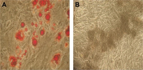 Figure 5 The multilineage potential of rat mesenchymal stem cells after incubation with the copolymer.Note: After incubating with PEG-PEI 14 μg/mL for eight hours, rat mesenchymal stem cells were induced to differentiate into adipocytes (A red cells) and osteoblasts (B black cells). Original magnification × 400.Abbreviation: PEG-PEI, polyethylene glycol-grafted polyethylenimine.