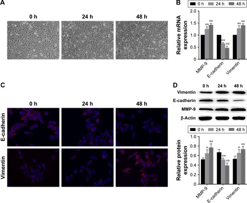 Figure 1 TGF-β1 induces EMT in EC-1 cells.