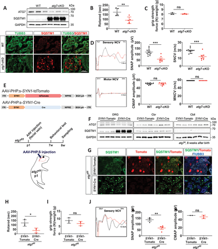 Figure 1. Atg7-deficiency in DRG neurons induced postnatal sensory neuropathy. (A) Demonstration of atg7 knockout (atg7-cKO)) by western blot analysis against ATG7 and SQSTM1/p62 or by immunofluorescence (IF) staining against SQSTM1 in the DRG from Avil-atg7-cKO and WT mice at 2 months. Scale bar: 50 μm. (B, C) The rotarod performance (B) and grip strength test (C) for WT and Avil-atg7-cKO mice. (D) Sensory and motor nerve conduction velocity (NCV) test. SNAP; sensory nerve action potential. CMAP; compound motor action potential. (E) Design of AAV-mediated Atg7 knockdown in mouse DRG. SYN1-Cre; SYN1-Cre recombinase. (F) Western blot analysis showing the levels of ATG7 and SQSTM1 in the DRG, cerebrum (Cbr) and cerebellum (Cbll) of SYN1-atg7-cKO and SYN1-tdTomato mice. (G) Representative IF staining against SQSTM1 in DRG from SYN1-tdTomato and SYN1-atg7-cKO (SYN1-Cre) mice. Scale bar: 50 μm. (H, I) The rotarod performance (H) and grip strength test (I) for SYN1-tdTomato and SYN1-atg7-Cko mice. (J) NCV test for SYN1-tdTomato and SYN1-atg7-Cko mice. *; p < 0.05, **; p < 0.01, ns; non-significant. Each dot in figures indicate the number of animals.