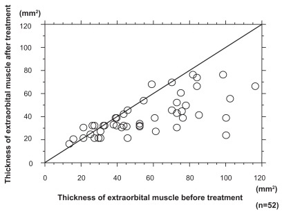 Figure 1 This shows the degree of extraocular muscle thickening in coronal slice pre- and poststeroid pulse treatment.