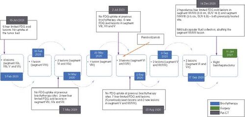 Figure 1. Timeline showing the PET-CT scan, high-dose rate interstitial brachytherapy liver for the 15 lesions and surgery.