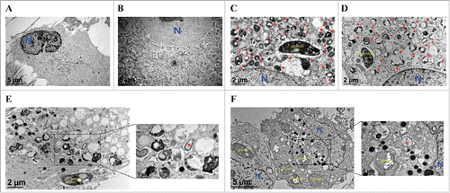 Figure 5. Ultrastructural morphology of normal and T. gondii-infected hUC-MSCs overexpressing Mcl−1. The ultrastructural morphology of hUC-MSCs infected with adenovirus expressing (A) DsRed alone or (B) DsRed-Mcl−1. hUC-MSCs overexpressing (C) DsRed and (D) DsRed-Mcl−1 were infected with T. gondii at an MOI of 5 for 24 h, and autolysosomes (red arrows) were detected by using TEM. hUC-MSCs overexpressing (E) DsRed and (F) DsRed-Mcl−1 were infected with T. gondii at an MOI of 5 for 24 h, and autophagosomes (red asterisks) were detected by TEM.