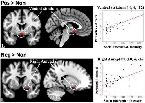 Figure 2. Brain areas correlated with social interaction intensity scores for emotional words. Upper image depicts the left ventral striatum (−4, 4, −12), demonstrating a significant positive correlation with social interaction intensity scores in the Positive > Nonword contrast (FWE-corrected p < .05 at the cluster-level in the whole brain). Bottom image depicts the right amygdala (18, 4, −16), showing a significant positive correlation with social interaction intensity scores in the Negative > Nonword contrast (FWE-corrected p < .05 at the voxel-level in SVC). Y-axis: mean parametric estimates for each area; X-axis: social interaction intensity scores.