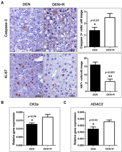 Figure 2 HDAC1/2 inhibition affects cell cycle and apoptosis in HCC. (A) Morphometric counts of immunohistochemically stained liver sections show that Romidepsin treatment increases apoptosis (Caspase-3) and decreases proliferation (Ki-67) in neoplastic hepatocytes. This effect co-existed with significant differences in the expression of cell cycle and apoptosis regulators such as CK2a (B) and HDAC2 (C). IHC; Diaminobenzidine chromogen, Hematoxylin counterstain. Scale bars: 25 μm. Numbers on the y-axis of bar graphs correspond to the mean±SEM of the parameters assessed. *p<0.05, ** p<0.001.Abbreviations: CK2a, casein kinase 2, alpha 1 polypeptide; DEN, diethylnitrosamine; HDAC2, histone deacetylase 2; Ki-67, antigen identified by monoclonal antibody Ki 67; R, Romidepsin.