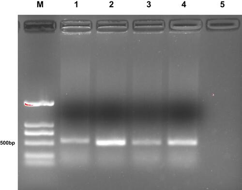 Figure 2 Agarose-gel electrophoresis of the positive clones. M, DNA marker DL2000; lanes 1–4, positive clones; lane 5, negative control.