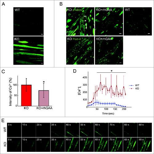 Figure 2. Assessment of Ca2+ levels and flux in WT and KO muscle cells. (A) WT and KO myotubes (7 d in differentiation medium) were loaded with Fluo-4 dye and analyzed by confocal microscopy. The images show a significant increase in the steady-state level of cellular Ca2+ in the KO myotubes. Bar = 10 μm. (B) KO myotubes were treated with rhGAA at 5 μM for 4 d; the treatment resulted in efficient glycogen clearance (top; arrows point to glycogen deposition in untreated KO myotube) and a modest reduction of Ca2+ levels (bottom and (C) graphical representation of the images). Lysosomal glycogen in live cells was detected by the incorporation of fluorescent glucose derivative 2-NBDG [2-(N-(7-nitrobenz-2-oxa-1,3-diazol-4-yl)amino)-2-deoxyglucose] into glycogen. Bars = 10 μm. (D and E) Time-lapse experiment showing progressive influx of Ca2+ after its addition to the medium; the images, taken every 10 sec by confocal microscopy, illustrate a faster uptake of Ca2+ in the KO myotubes. Note the higher level of Ca2+ in the KO myotubes compared to the WT at the onset of the experiment. Ca2+ flux in WT and KO myotubes was calculated by conversion of the intensity of staining to molarity (nMol), which was then plotted versus time; the graph in (D) shows a much higher and sustained rise of Ca2+ in the KO. Asterisks indicate P < 0.05.