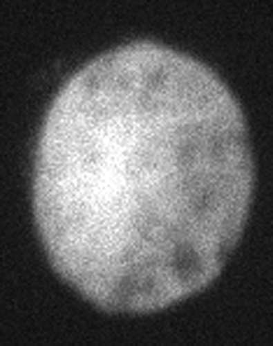 Figure 6. Confocal cell image.