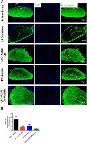 Figure 3 Effect of ADSCs-CM and aspirin on demyelination levels of the optic chiasm. (A) FluoroMyelin staining of optic chiasm’s sections on day 14 post LPC injection. DAPI: nucleus stain. Scale bar: 100 µm. (B) ADSCs-CM, aspirin or combination of ADSCs-CM and aspirin decreased the extent of demyelination areas. One-way ANOVA followed by Tukey post-test were used for statistical analysis. **P<0.01 and ***P<0.001 compared to LPC + vehicle. n=3.