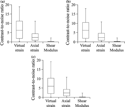 Figure 8. Contrast-to-noise ratios for our method, strain-based method, and modulus-based method at each noise level: (a) 0%, (b) 2% and (c) 4%. Our method produced significantly better contrast-to-noise ratios than the other two methods (p<0.001 at each noise level).