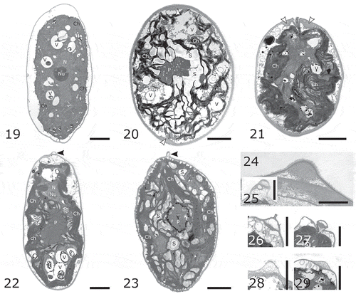 Figs 19–29. Transmission electron micrographs of studied strains. Fig. 19. Chloromonas reticulata CAUP G 1302. Fig. 20. Ostravamonas chlorostellata CAUP G 1401. Fig. 21. O. chlorostellata SAG 12.72. Fig. 22. O. meslinii SAG 75.81. Fig. 23. C. gracillima SAG 25.87. Papillae of strains: Figs 24–25. CAUP G 1401. Fig. 26. SAG 12.72. Fig. 27 SAG 75.81. Fig. 28. SAG 25.87. Fig. 29. CAUP G 1302. White arrowheads indicate cell wall thickenings, black arrowheads indicate papillae. Abbreviations: Ch, chloroplast; L, lipid droplet; N, nucleus, Nu, nucleolus; P, pyrenoid; S, starch; V, vacuole. Scale bars: Figs 24, 28 = 1 µm. Figs 19–23, 25–27, 29 = 2 µm.