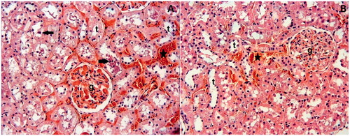 Figure 3. (A) Dex10 Group: While glomeruli (g) appear normal, tubules (t) and interstitial area show slight degenerative changes, such as epithelial desquamation (arrows) and interstitial hemorrhage (asterisks). (B) Dex100 Group: The glomeruli and tubules appear nearly normal. Slight interstitial hemorrhage (asterisks) is present. H–E; X66.