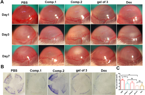 Figure 4 (A) Photographs of the anterior ocular segment representing morphological differences induced by different treatments; (B) CNV area at 7 days after alkali burn by hematoxylin perfusion; (C) area of corneal neovascularization at 7 days after alkali burn. Data represent the mean ± SD of three mice per group, one-way ANOVA, *p < 0.05, **p < 0.01.