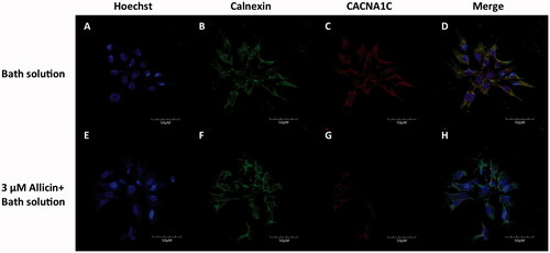 Figure 3. Representative images of subcellular localization of Cav1.2 proteins in primary CMs. The upper line shows representative images of primary CMs without allicin, and the lower row shows representative images of primary CMs with allicin. n = 1250 cells, 25 μL, 5 × 104 cells/mL.