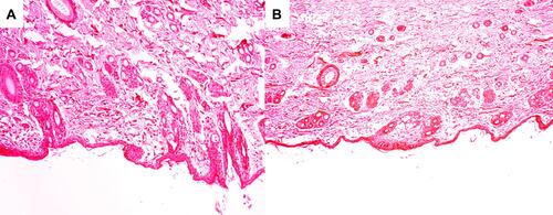 Figure 6 Histopathological examination of rabbit back skin untreated (control) (A) and treated with lyophilized nanovesicular gel (B) after treatment for three days (X100).