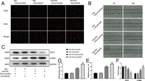 Figure 3 Sirt6 knockout contributes toward proliferation, migration, and mesenchymal features expressing in CMECs exposed to HG+PA. (A) Representative images from the EdU proliferation assay in CMECs treated as indicated. Red fluorescence represents proliferating cells (n = 5). (B) Representative images from the scratch-migration assay in CMECs (n = 5). (C) Western blotting and quantitative analysis of α-SMA, and CD31 protein levels in CMECs treated as indicated (n = 5). (D) Quantitative analysis of EdU proliferation assay results (n = 5). (E) Quantitative analysis of scratch-migration assay results (n = 5). (F) Quantitative analysis of α-SMA, and CD31 protein levels in CMECs treated as indicated (n = 5). *P < 0.05 vs NG+Ad-scramble; #P < 0.05 vs NG+Ad-shSirt6; ^P < 0.05 vs HG+PA+Ad-scramble.