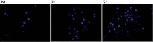 Figure 3. Apoptosis detection in HT29 cancer cells on treatment with zinc oxide nanoparticles by Hoechst 33342 staining and fluorescence microscopy. Control (A), 20 μg/ml (B) and 50 μg/ml (C) of ZnO nanoparticle treatment.