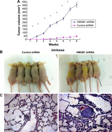 Figure 6 Effects of HMGB1 knockdown on tumor growth in vivo.