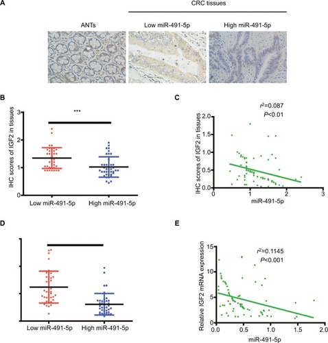 Figure 6 The relationship between miIR-491-5p and IGF2 in CRC tissues.Notes: (A) Representative IHC staining (×200) for IGF2 from CRC tissues and matched ANTs. (B) IHC scores of IGF2 in low miIR-491-5p CRC tissues were markedly higher than those in high miIR-491-5p CRC tissues. (C) The correlation between the levels of miIR-491-5p expression and IHC scores of IGF2 in CRC tissues. (D) qRT-PCR was employed to measure the expression of IGF2 mRNA in 80 CRC specimens and corresponding ANTs. (E) The correlation analysis was performed between IGF2 mRNA and miIR-491-5p expression levels. Data are shown as mean ± SD.***P<0.001.Abbreviations: ANTs, adjacent normal tissues; CRC, colorectal cancer; IHC, immunohistochemical; NC, negative control; qRT-PCR, quantitative real-time PCR.