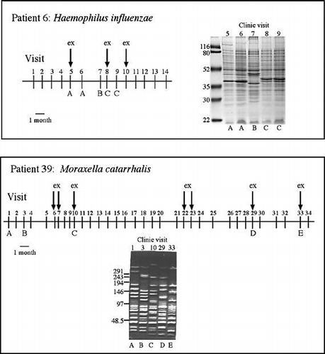 Figure 2. Time lines and molecular typing for patients with COPD. The horizontal line is a time line, with each number indicating a clinic visit. The arrows indicate exacerbations. Isolates of H. influenzae and M. catarrhalis were assigned types based on sodium dodecyl sulfate-polyacrylamide gel and pulsed-field gel electrophoresis respectively. The types are indicated by letters A to E. Molecular mass standards are noted on the left of the gels. Reproduced with permission from Sethi et al. (Citation[20]).