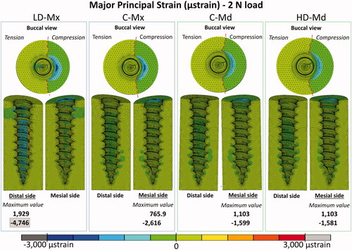 Figure 4. Major strain distribution (µstrain) distribution for the four FE models under 2 N: low-dense maxilla (LD-Mx), control maxilla (C-Mx), control mandible (C-Md), and high-dense mandible (HD-Md).