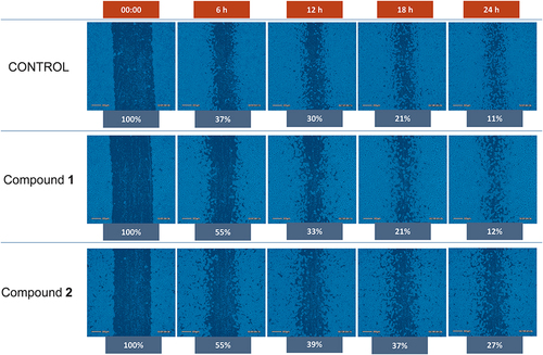 Figure 7 Representative images for the wound healing assay against MDA-MD-231 breast cancer cell line for compound 1 and 2 at concentration 10 µM.