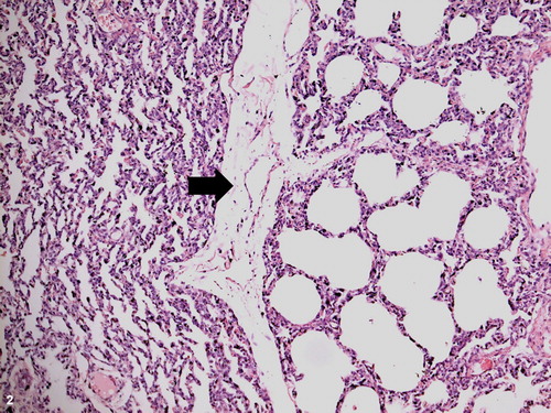 Figure 2. Irregular pulmonary expansion, lung lobe, ovine. Areas of atelectasis (left side) and expansion (right side) separated by a septum (arrow). H&E stain; bar = 100 μm.