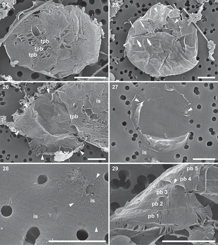 Figs 24–29. Perizonial bands in auxospores; scanning electron microscopy. Fig. 24. Partially damaged auxospore with some transverse perizonial bands (tpb) exposed. Note that these bands do not overlap, they disassociate along abutting edges. Fig. 25. Dorsal part of large auxospore covered with transverse perizonial bands, one or two of them (possibly two ends of the same; arrowheads) are twice as wide as the others (thin arrows). Note at least two layers of intersecting bands; an overlapping (thick arrows) and underlying (thin arrows) set of bands. Fig. 26. Rounded initial valve (delineated by 5 arrowheads) in a partially disarticulated auxospore showing radial ribs and pores between them; transverse perizonial bands (tpb) overlay the valve while incunabular scales (is) overlay the band in this location. Fig. 27. Nearly circular initial epivalve; note misaligned setae (arrowheads; seta on right is draped by two small scales), lack of rimoportula and striation much finer than that on a typical vegetative valve. A large incunabular scale (is) is visible below. Fig. 28. Incunabular scales (is; one delineated by three arrowheads) showing their fine ribbing. Fig. 29. Five transverse perizonial bands (pb 1–5) showing their fine structure, lack of overlap and multilayered organization. Bands 4 and 5 lay over bands 1–3 most clearly at the arrowhead. Scale bars: Figs 24–29, 5 µm.