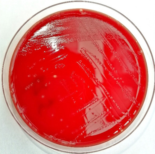 Figure 1 Result of pure culture of the bacterial isolate after 48 h.