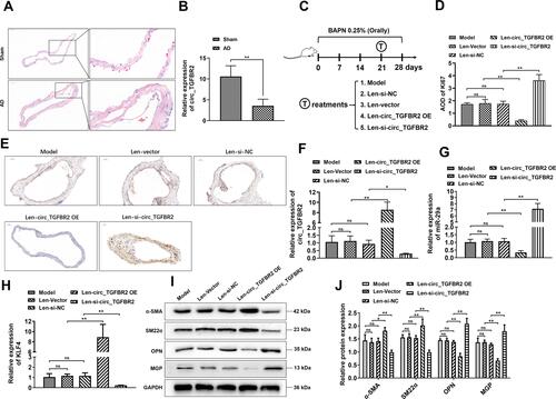 Figure 7 circ_TGFBR2 regulated the promotion of AD in vivo. (A) HE staining results showed the obvious vascular media degeneration and the disordered muscle fibers assembly with the increased middle membrane thickness in the AD group compared with the Sham group (n = 3). Scale bar = 50 µm. (B) qRT-PCR analysis revealed that the level of circ_TGFBR2 was down-regulated in AD samples compared with the Sham group (n = 5). (C) A schematic diagram showing the process of AD model construction and the time points and treatments of each group. AD rat model was orally administrated by BAPN (0.25%) for 28 days and at 21 days after BAPN administration, each group was treated as indicated. (D and E) Immunohistochemistry analysis was applied to assess the expression of Ki67 in aorta tissues (n = 3). Scale bar = 50 µm. (F–H) qRT-PCR analysis was carried out to evaluate the expression level of circ_TGFBR2 (F), miR-29a (G), and KLF4 (H) of aorta tissues (n = 5) (I and J) Phenotype switch-related proteins expression of aorta tissues was identified via Western Blot analysis (n = 3). *p < 0.05, **p < 0.01, ns = non-significant in 2-tailed t-test (B) and Tukey’s post-hoc comparisons test (D, F, G, H and J).
