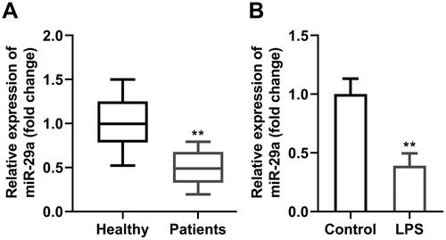 Figure 1. MiR-29a is downregulated in periodontitis. MiR-29a expression in (A) PDL tissues from patients with periodontitis and healthy controls, and (B) HGFs before and after LPS treatment evaluated by RT-qPCR. **p < 0.01. PDL: periodontal ligament. HGF: human gingival fibroblast. LPS: lipopolysaccharides. RT-qPCR: reverse transcription quantitative real-time PCR.