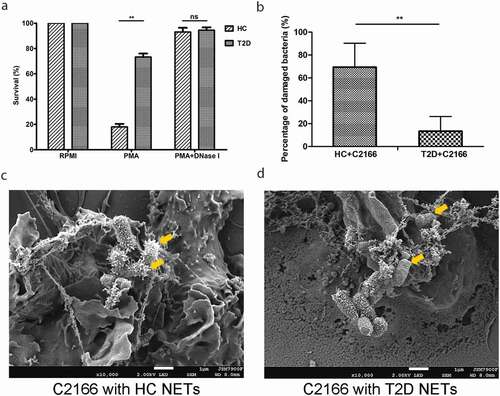 Figure 2. (a) Healthy controls (HC) and type 2 diabetes mellitus (T2D) patients NETs in vitro killing of CR-hvKP C2166. NETs were induced by 100 nM PMA for 3 h, then C2166 (1 × 106 CFUs) were added and co-incubated for another hour. After cells lysing, C2166 were plated on LB agar and enumerated the next day. HC and T2D patients NETs were combined with C2166 and bacterial surface were analyzed under scanning electron microscope. The mean percentage of surface-damaged bacteria by HC and T2D NETs was compared and shown in (b). Representative images were presented in (c) and (d). **p < 0.01, ns: no significance.