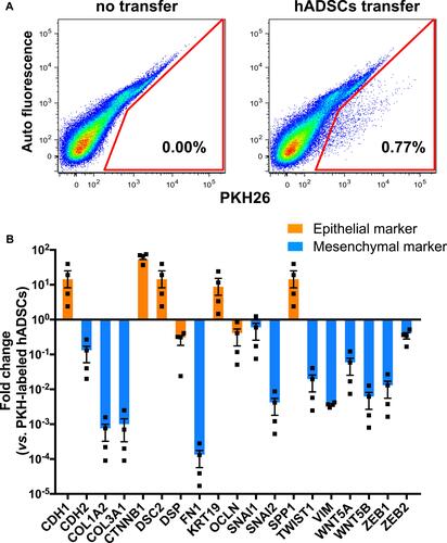 Figure 3 Gene expression of epithelial and mesenchymal genes in hADSCs isolated from lungs.