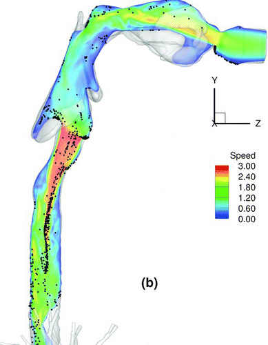 FIG. 16 Particle transport profiles at normalized time t* = 0.13. (a) 2.5-μm particles with Stkglottis= 0.006, (b) 20-μm particles with Stkglottis= 0.405. The unit of air speed is m/s.