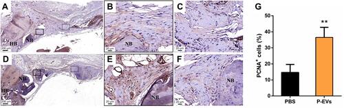 Figure 4 Evaluation of cell proliferation in the bone repair area. (A–C) Immunohistochemical staining of proliferative cell nuclear antigen (PCNA) in the control side. (D–F) More PCNA+ cells were found in the side treated with periodontal ligament stem cell-derived small extracellular vesicles (P-EVs). Black boxes indicate the region near the host bone, and the dotted boxes indicate the region in the middle of the defect. (A and D) scale bar = 200 µm (in); (B and C, E and F) scale bar = 20 µm. (G) Quantitative analysis of PCNA+ cells on both sides of the bilateral calvarial bone defects in a rat model. PCNA+ cells were counted under 200× magnification and expressed as the percentage of positively stained cells. Data are expressed as mean ± standard deviation (representative images, n = 5). **P < 0.01.