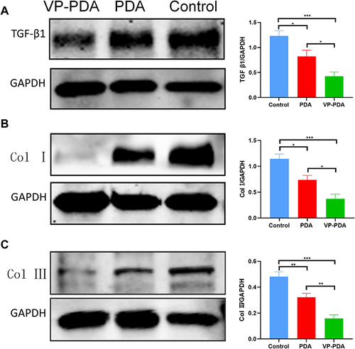 Figure 7 Verapamil-loaded polydopamine nanoparticles decreased the expression of (A) TGF-β1, (B) collagen type I, and (C) collagen type III in the repaired tendons at four weeks after surgery. PDA NPs, polydopamine nanoparticles. VP-PDA NPs, verapamil-loaded polydopamine nanoparticles. The bars represent mean ± SEM (n = 6 per group). *p<0.05; **p<0.01; ***p<0.001.