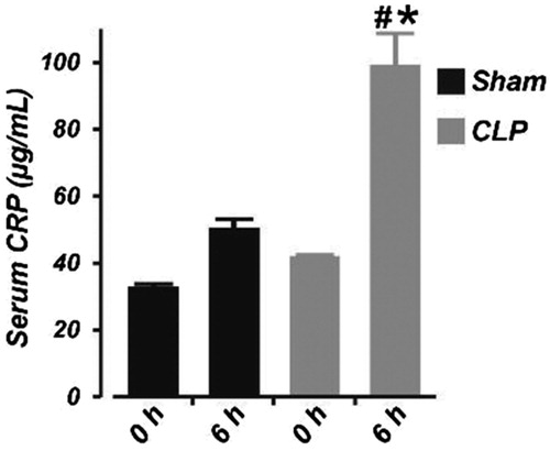 Figure 1. Six hours of cecal ligation and puncture elevates serum concentration of C-reactive protein in neonatal pigs. Mean data obtained from ELISA showing the serum concentration of C-reactive protein at 0 and 6 h in sham-operated (n = 6) and septic (n = 7) neonatal pigs. #p < .05 versus 0 h CLP; *p < .05 versus 0 and 6 h Sham.