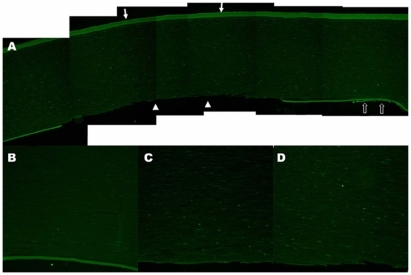 Figure 2 TUNEL assay of the human cornea. After three freezing–thawing (F/T) cycles, there was a well demarcated area of denuded Descemet’s membrane with no endothelial cells (arrowheads) where the cryoprobe had been applied transcorneally (arrows) A) The surrounding corneal endothelial cells were TUNEL-positive (empty arrows) A) A few TUNEL-positive cells were also observed in the posterior corneal stroma after one F/T cycle B) and more TUNEL-positive cells were present in the cornea after two F/T cycles C) After 3 F/T cycles, many TUNEL-positive cells were found throughout the whole thickness of the cornea D) Descemet’s membrane was intact in the single F/T cornea (B), while it was stripped off in the double and triple F/T corneas (C, D). Original magnification X50 (A), X100 (B, C, D).
