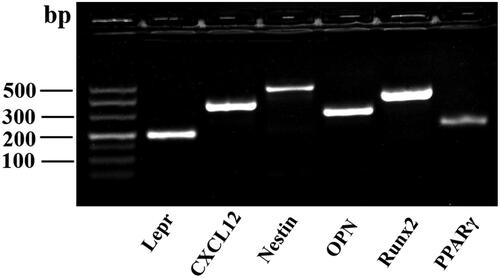 Figure 1. The bone-disassociated cells were isolated and cultured to the third generation in vitro, and agarose gel electrophoresis was used to identify perivascular hematopoietic niche-related gene expression.