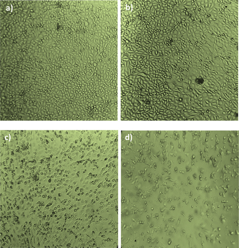 Figure 9. Anticancer activity of chitosan with and without drug against the MCF7 Cell lines (a) control (b) chitosan without drug (c) chitosan with drug conc. IC50 50 μg/mL d) chitosan with drug conc. 300 μg/mL.