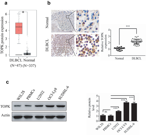 Figure 1. TOPK is highly expressed in human DLBCL. (a) The GEPIA database demonstrated the overexpression of TOPK in DLBCL tumor tissues compared to normal tissues (*p < 0.05). (b) IHC staining revealed nuclear staining of TOPK in the DLBCL tissue array, control group (20 samples), and DLBCL group (40 samples). The values were normalized to control tissue expression, and the values are represented as the mean ± S.D. (***p < 0.001). (c) TOPK protein levels were measured in DLBCL cell lines (U2932, OCI-LY8, SUDHL-6), WIL2S cell lines and PBMCs using Western blots. The data represent the mean ± S.D. for three individual experiments (ns: no significant difference, **p < 0.01, ***p < 0.001, n = 3).