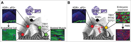 Figure 1. Role for endothelial progenitor reprogramming by Hedgehog in rhabdomyosarcoma oncogenesis. A) Model of endothelial cell and skeletal muscle development from Kinase insert domain receptor positive (KDR+) progenitors in the pharyngeal mesoderm on a Waddington epigenetic landscape. B) Proposed model of fusion-negative rhabdomyosarcoma tumorigenesis. Constitutive activation of Hedgehog signaling (Shh) by expression of constitutively active oncogenic SMOOTHENED (SmoM2) in aP2-Cre expressing endothelial progenitor cells results in their embryonic expansion, reprogramming and myogenic transdifferentiation into fusion-negative rhabdomyosarcoma. Immunostaining for Tomato (Red), Myosin Heavy Chain (Green) and DAPI (Blue). Abbreviations in figure as follows: adipose protein 2 (aP2), T-box 1 (TBX1), Paired-like homeodomain transcription factor 2 (PITX2), Transcription factor 21 (TCF21), rhabdomyosarcoma (RMS). Adapted from.Citation9