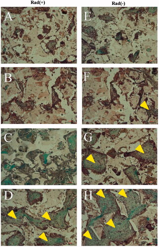 Figure 12. Histological evaluation with Masson Trichrome staining. Histological sections of rabbit radius defects with (A–D) and without (E–H) X-ray irradiation 12 weeks after the application of control (A and E), BM (B and F), BMP (C and G) and BM/BMP (D and H). The yellow triangle indicates the new bone formation. Scale bars are 100 μm.
