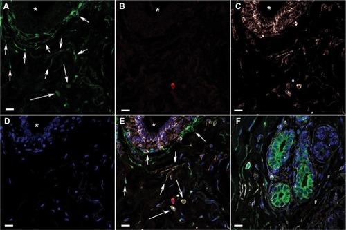 Figure 1 Confocal microscopy images of triple immunofluorescence-labeled histologically normal breast tissue.
