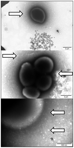 Figure 8 Interaction between Candida albicans and gold nanoparticles. Arrows indicate the substance of different electron density released by cells.