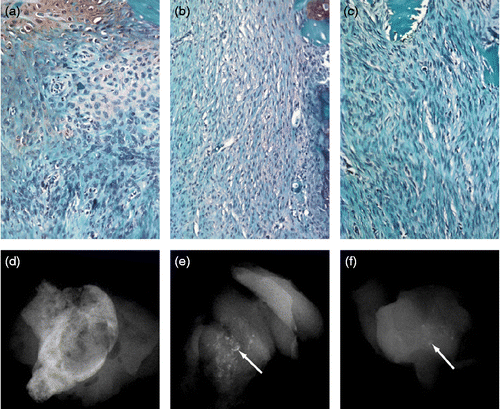 Figure 2.  Histology and X-ray analysis of BMP-treated implants after 14 days. Saffranin O stain of representative sections of implants containing (a) 25 μg of rhBMP2, (b) 25 μg of rhBMP12, or (c) 25 μg of rhBMP13. Faxitron X-ray images of representative implants containing (d) 25 μg of rhBMP2, (e) 25 μg of rhBMP12, or (f) 25 μg of rhBMP13. The implants containing rhBMP2 consists of mostly bone, whereas the implants containing rhBMP12 or rhBMP13 consists of only small little bone spicules (arrows).